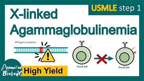 x linked agammaglobulinemia meaning.